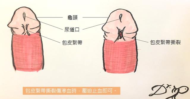 性福講座 男人最敏感的地方 關於 包皮繫帶 你應該了解三個影響 Manfashion這樣變型男