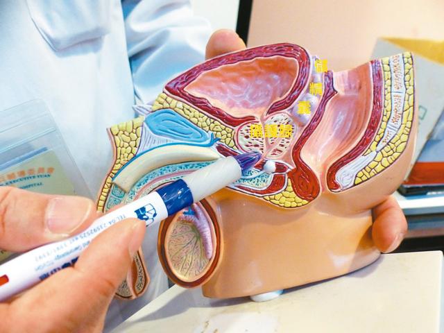 射精噴出「血精」?自慰過度、攝護腺發炎等 4 大症狀解析,男生千萬要注意!